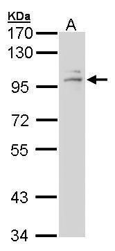 Glucocorticoid Receptor Rabbit Polyclonal Antibody