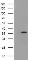 Glucose Transporter 5 GLUT5 Antibody