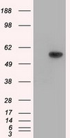 Glucose Transporter 5 GLUT5 Antibody