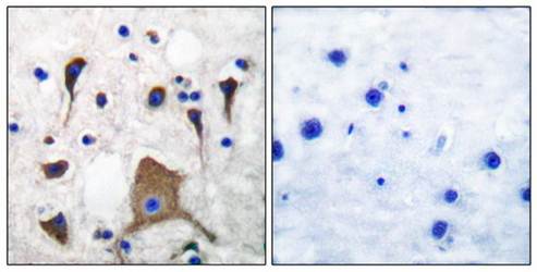 GluR5 Antibody
