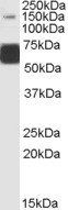 GLuR5/GRIK1 Antibody