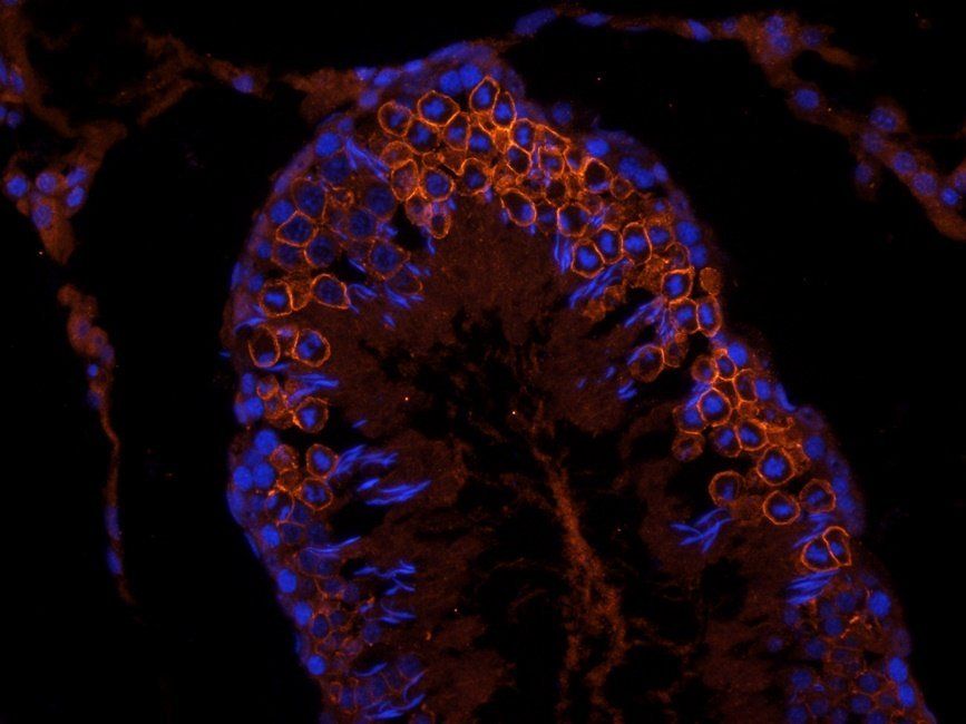 GLUT3 Rabbit Polyclonal Antibody