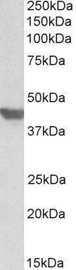SLC2A4/GLUT4 Antibody