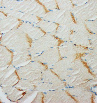 Glucose Transporter GLUT4/SLC2A4 Antibody