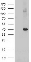 Glutathione S Transferase theta 2 Antibody