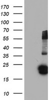 Glutathione S Transferase theta 2 Antibody