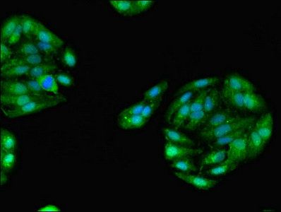 GPD1 Antibody