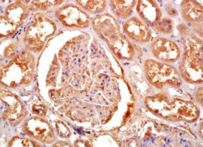 Glycerol kinase Rabbit Polyclonal Antibody
