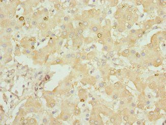 GLYCTK Antibody