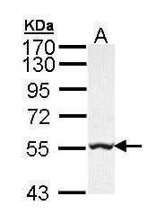 GLYCTK Rabbit Polyclonal Antibody