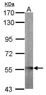 GLYCTK Rabbit Polyclonal Antibody