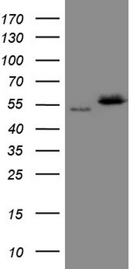 GM CSF Antibody