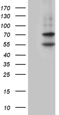 GM CSF Antibody