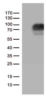 GM CSF Receptor alpha Antibody