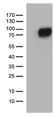 GM CSF Receptor alpha Antibody