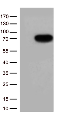 GM CSF Receptor alpha Antibody