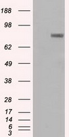 GM CSF Receptor alpha Antibody