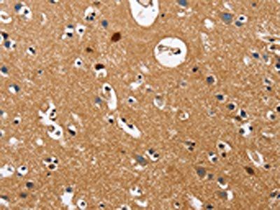 GNA13 Antibody