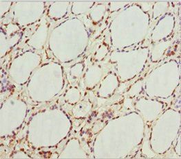 GNB1L Antibody