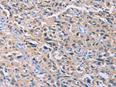 GNB5 Antibody