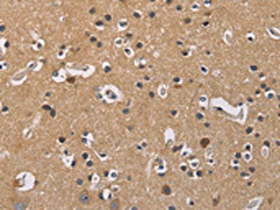 GNB5 Antibody