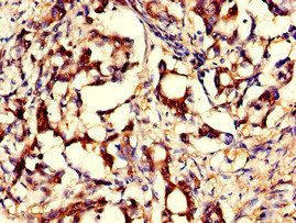 GNPNAT1 Antibody