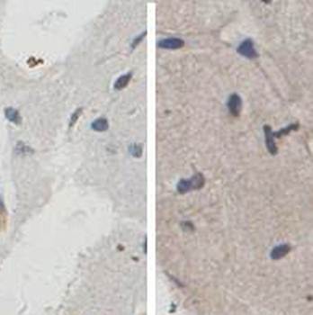 GNRH Rabbit Polyclonal Antibody
