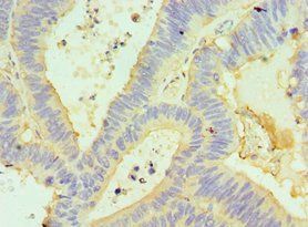 GORASP1 Antibody