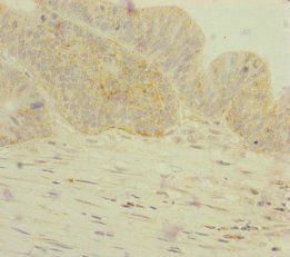 GORASP2 Antibody