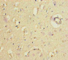 GORASP2 Antibody