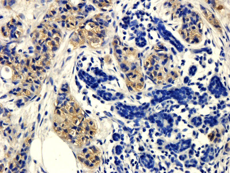 GP1BA Rabbit Polyclonal Antibody