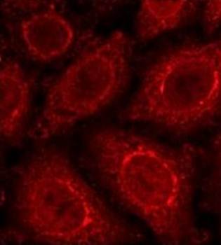 gp210 Antibody
