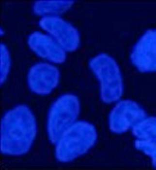 gp210 Antibody