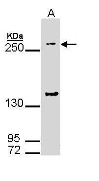 DIP2B Rabbit Polyclonal Antibody