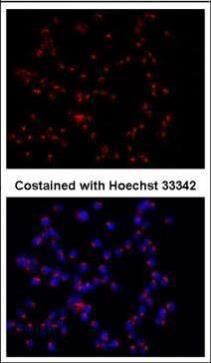 GOLPH2 antibody [C3], C-term