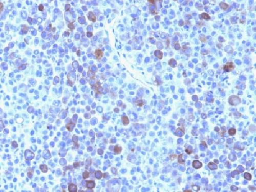 GPC3 Antibody