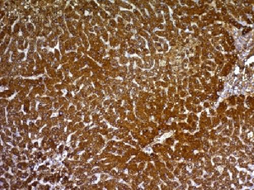 GPC3 Antibody