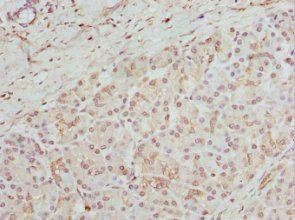 GPD2 Antibody