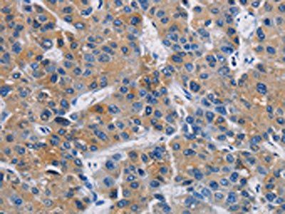 GPM6A Antibody