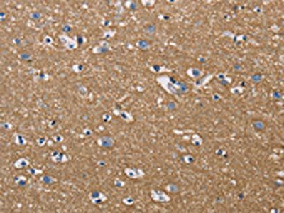 GPM6A Antibody