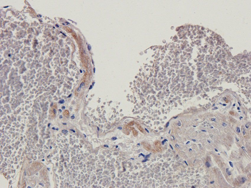 GPR133 Rabbit Polyclonal Antibody
