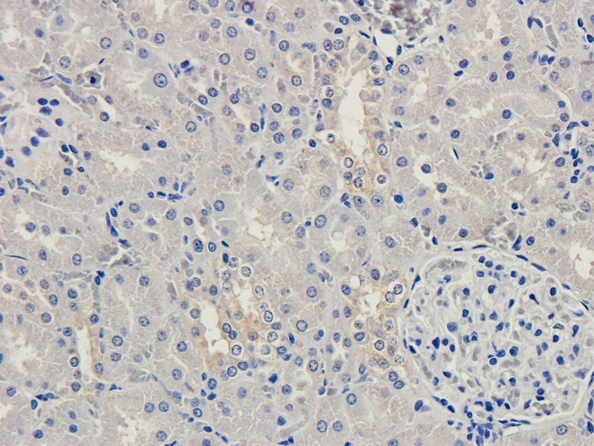 GPR133 Rabbit Polyclonal Antibody