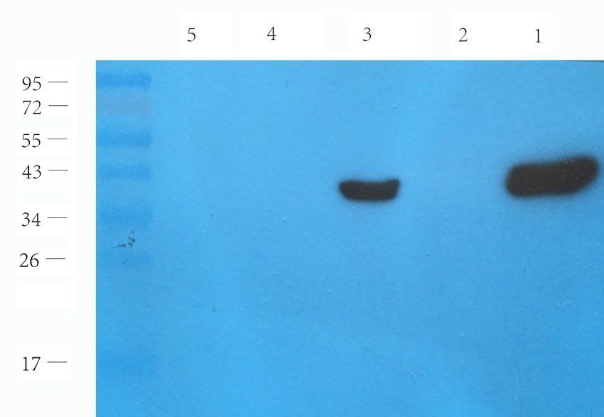 GPR133 Rabbit Polyclonal Antibody