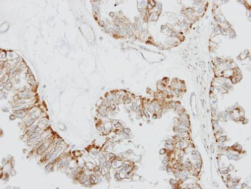 olfactory receptor family 51 subfamily E member 1 Antibody