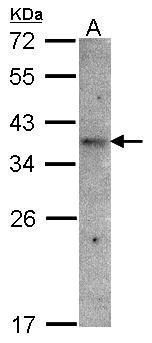 olfactory receptor family 51 subfamily E member 1 Antibody