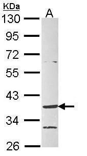 Endothelin 1 Rabbit Polyclonal Antibody