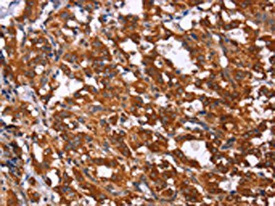 GPR65 Antibody