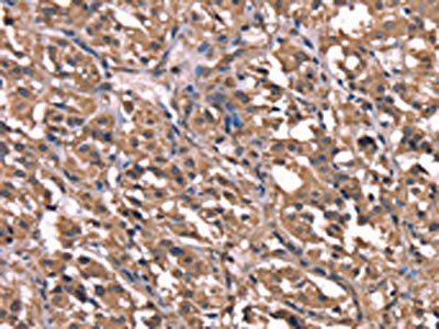 GPR65 Antibody