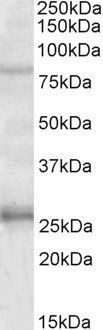 GPRIN3 Antibody