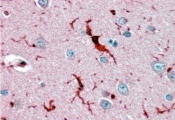 Glutathione Peroxidase 1 (isoform1) Antibody